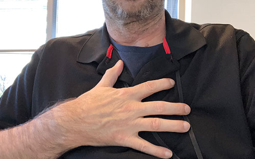 Amyotrophic lateral sclerosis bulbar onset with difficulty breathing